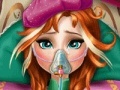 Oyunu Anna Frozen Flu Doctor