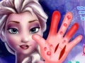 Oyunu Frozen. Hand surgery