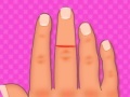 Oyunu Finger surgery