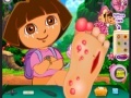 Oyunu Dora Foot Injuries