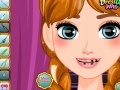 Oyunu Anna Frozen dentist