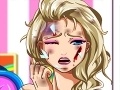 Oyunu Elsa Face Surgery