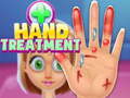 Oyunu Hand Treatment