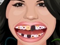 Oyunu Selena Gomez Perfect Teeth 